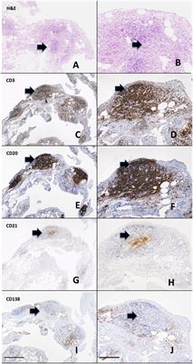 Can Synovial Pathobiology Integrate with Current Clinical and Imaging Prediction Models to Achieve Personalized Health Care in Rheumatoid Arthritis?